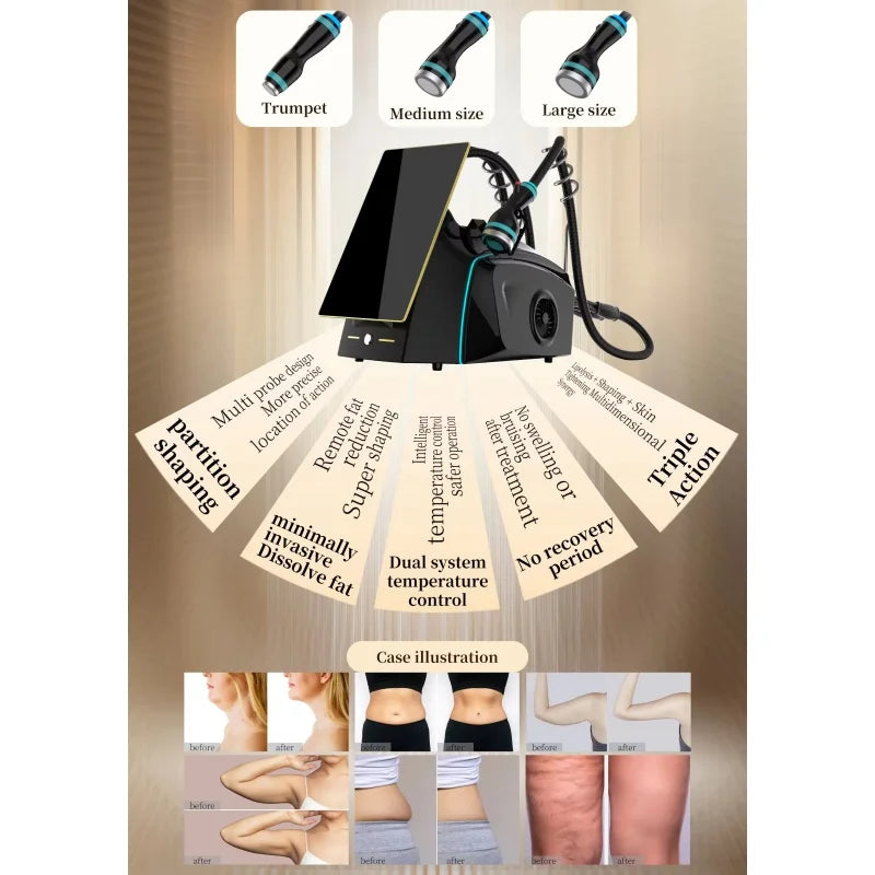 Onda Ice-Microwave Skin Tightening Machine 2.45GHz For Contouring